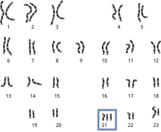 Chromosomes-abnormal - Abnormal Chromosomes Clipart - Large Size Png ...