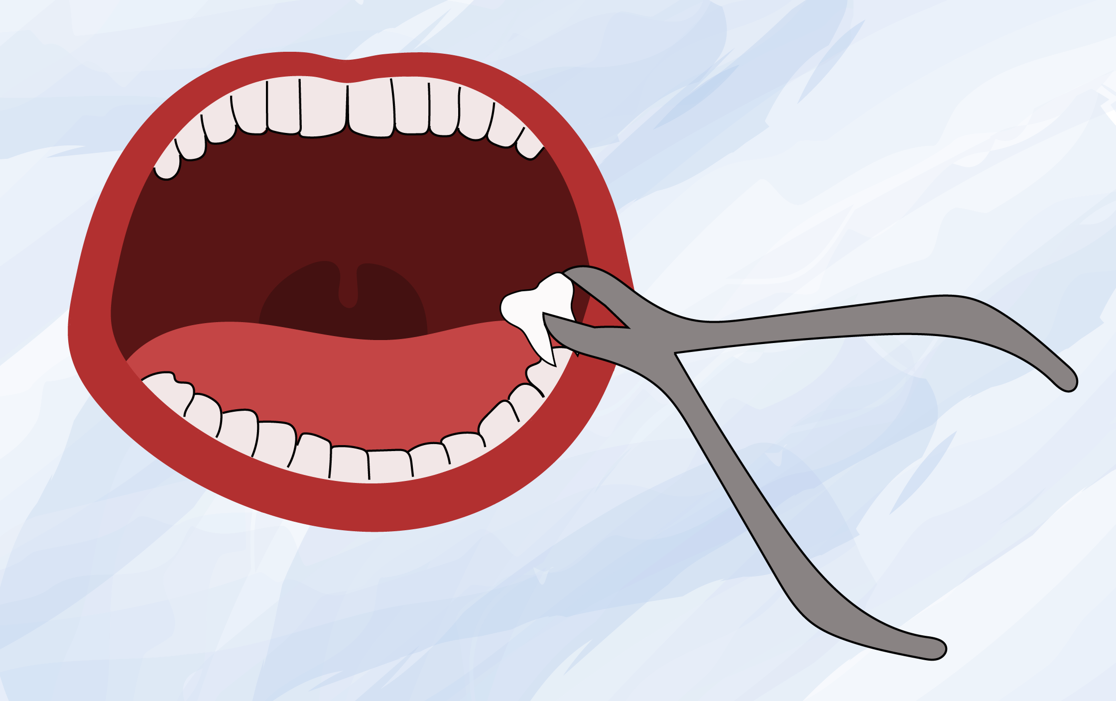 Не открывается рот челюсть. Зубы мультяшные. Мультяшный рот.