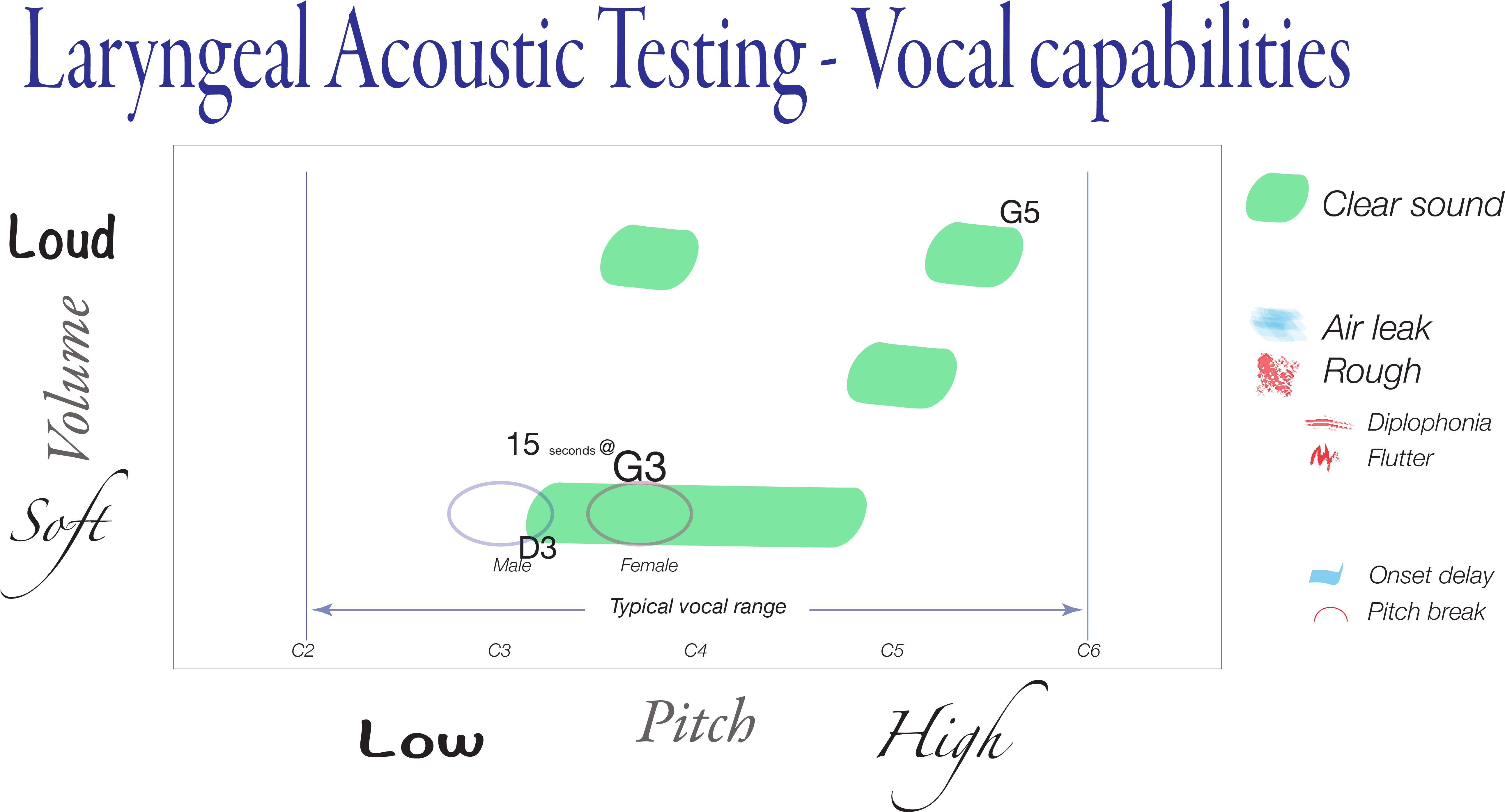 diagramming-a-loud-sound-production-task-human-voice-clipart-large