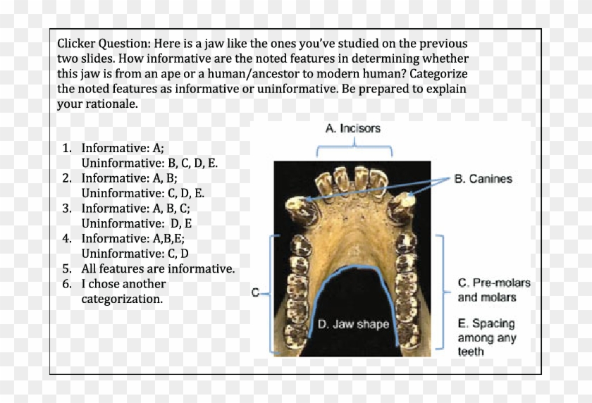 Jaw Analysis Question From A Case Study On Human Evolution - Strepsirhine Mandibular Dental Arcade Clipart